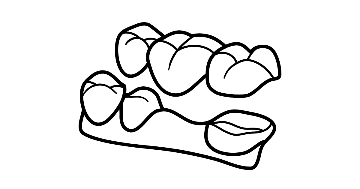 歯科ブリッジの治療の流れと期間｜どんな手順で進む？