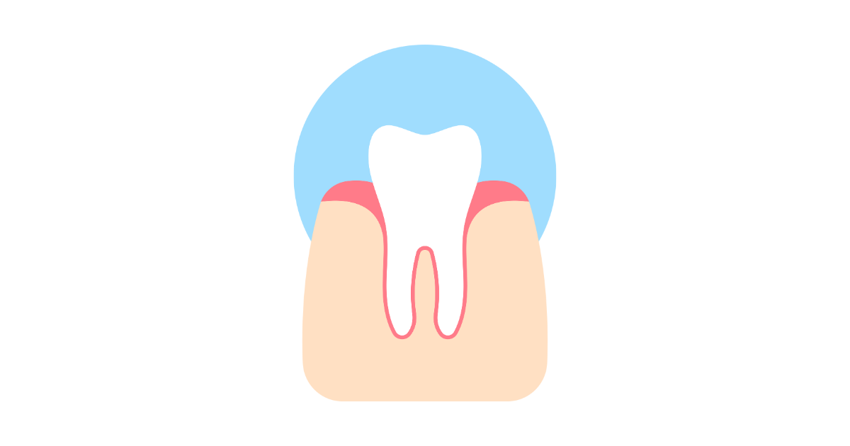 歯周病とは？｜放置するとどうなる病気なのか