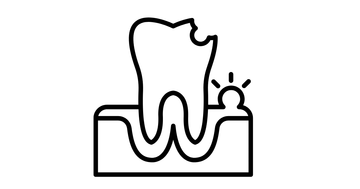 歯周病治療の費用はどれくらい？保険の範囲と自費の違い