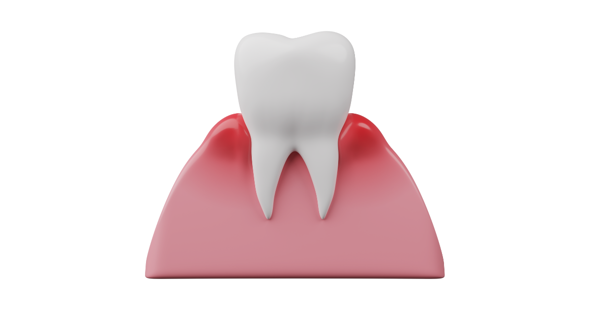 歯周病治療を受けるならどこが良い？歯科医院の選び方