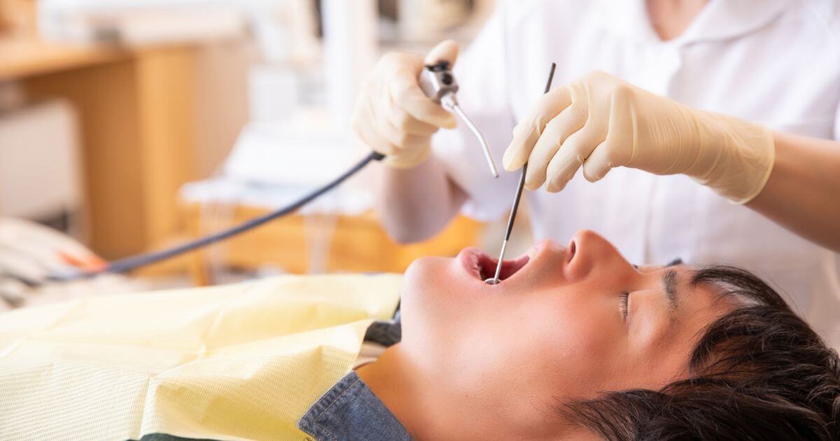 歯の黒ずみを歯科で診てもらう男性