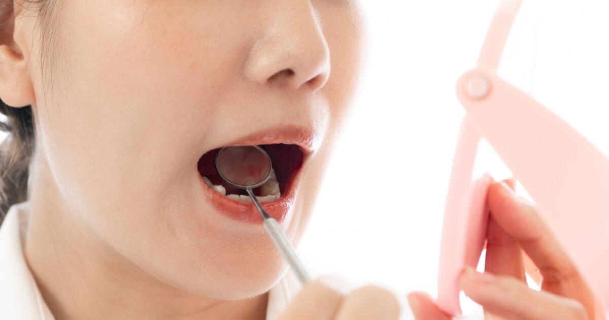 女性がデンタルミラーを使って歯と歯の間をセルフチェックしている様子