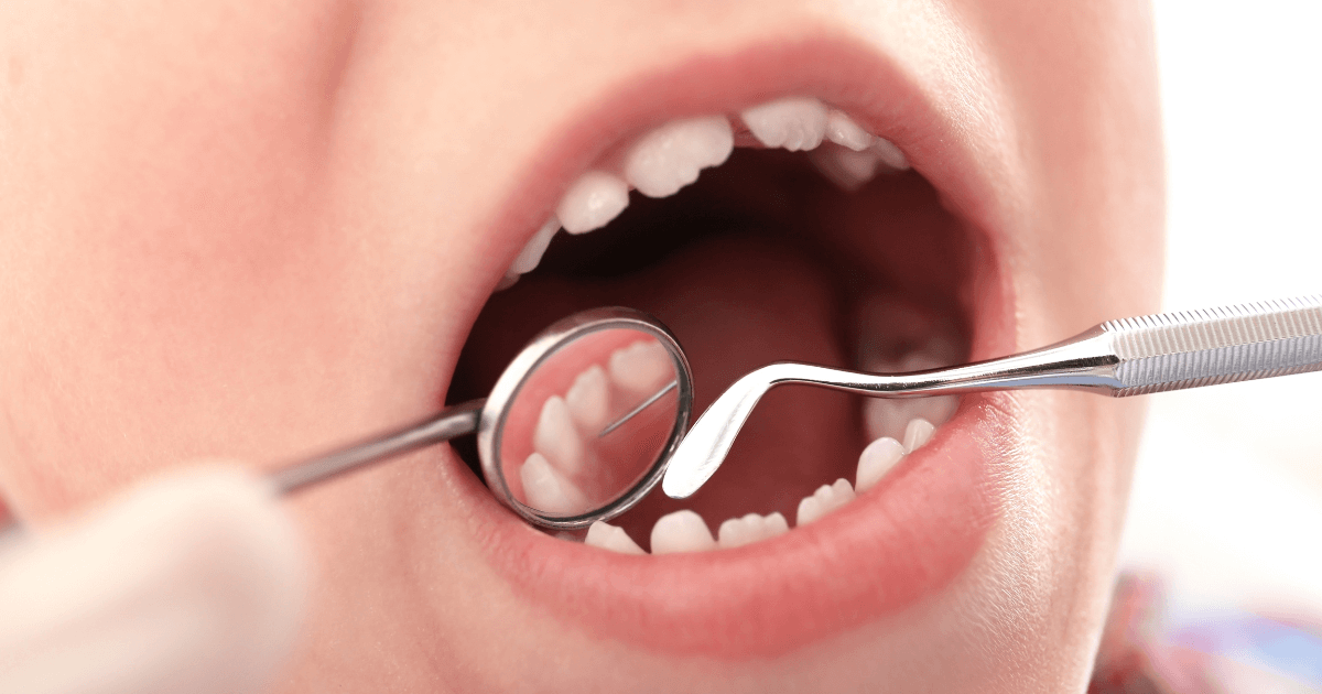 血餅が取れたかもしれない状態