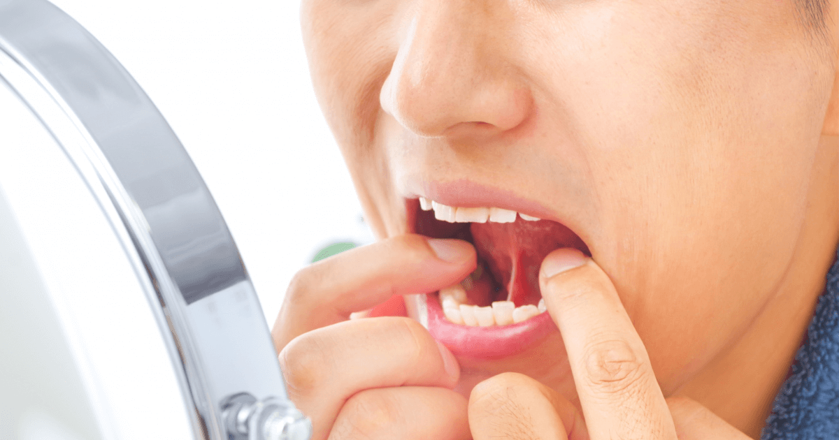 鏡で口の中を確認する男性