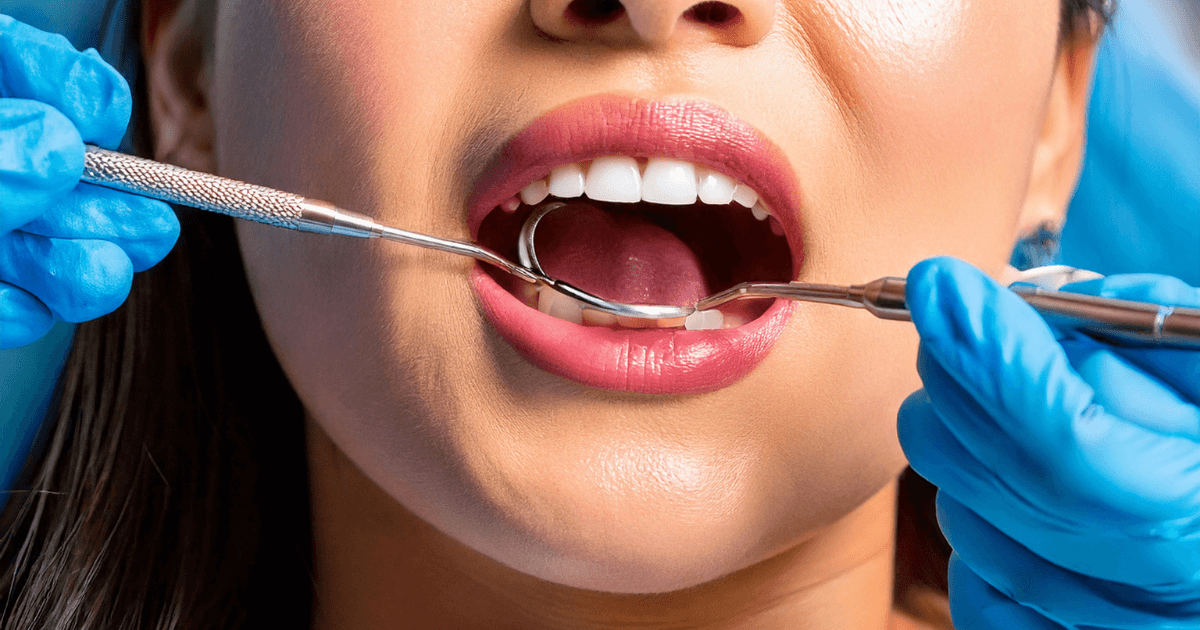 歯科医院で器具を使って歯を確認する様子