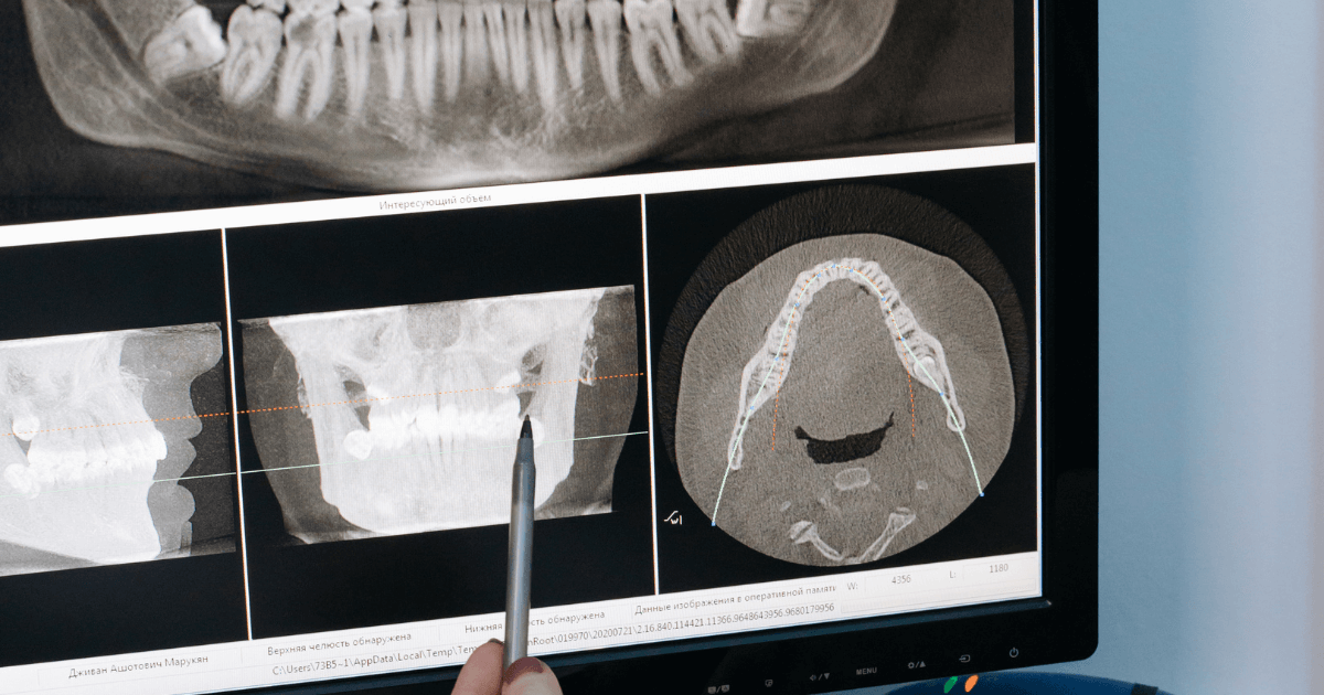 痛みが長引く・強くなる場合の対処法