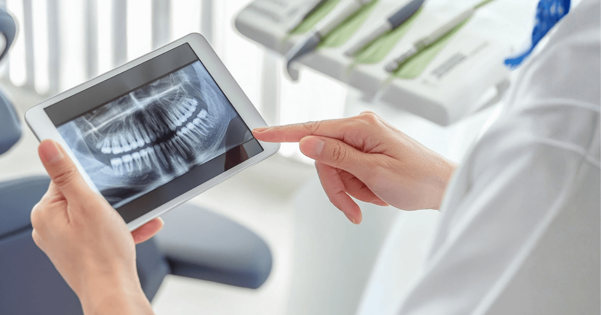 歯科医院でレントゲン画像を確認する医師と患者。歯の痛みが続くときに歯医者へ行くタイミングと注意点を示すイメージ。