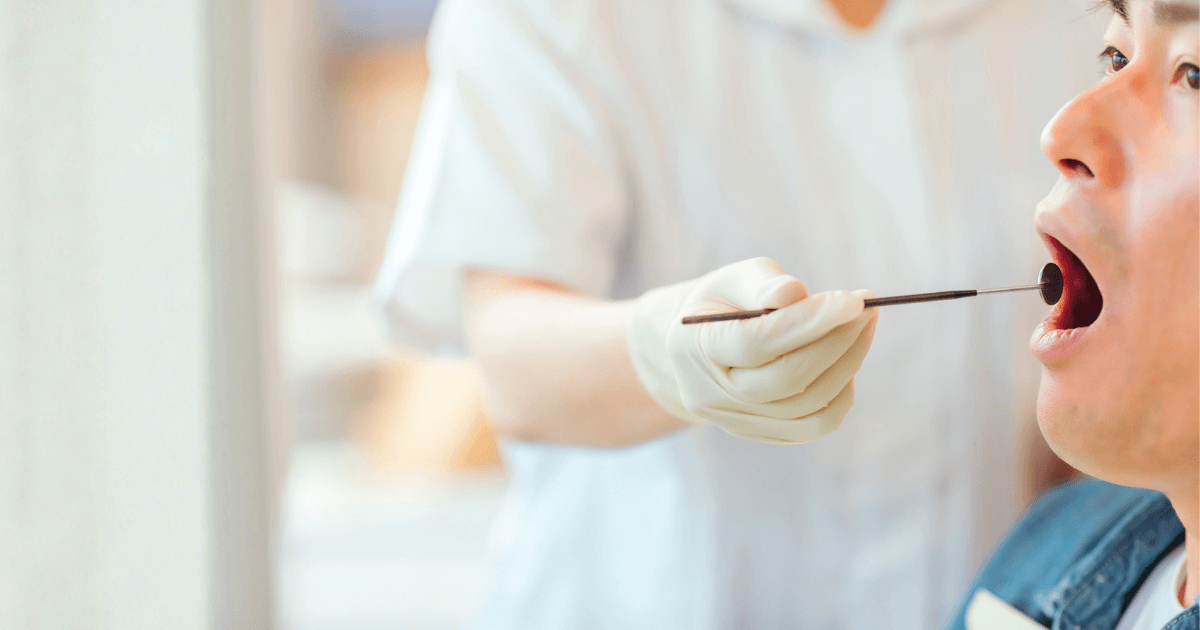 歯科医院で口の中を診察している様子のイメージ