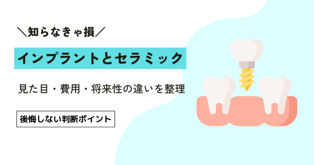 インプラントとセラミックの違いがわかる7つのポイントと後悔しない選び方