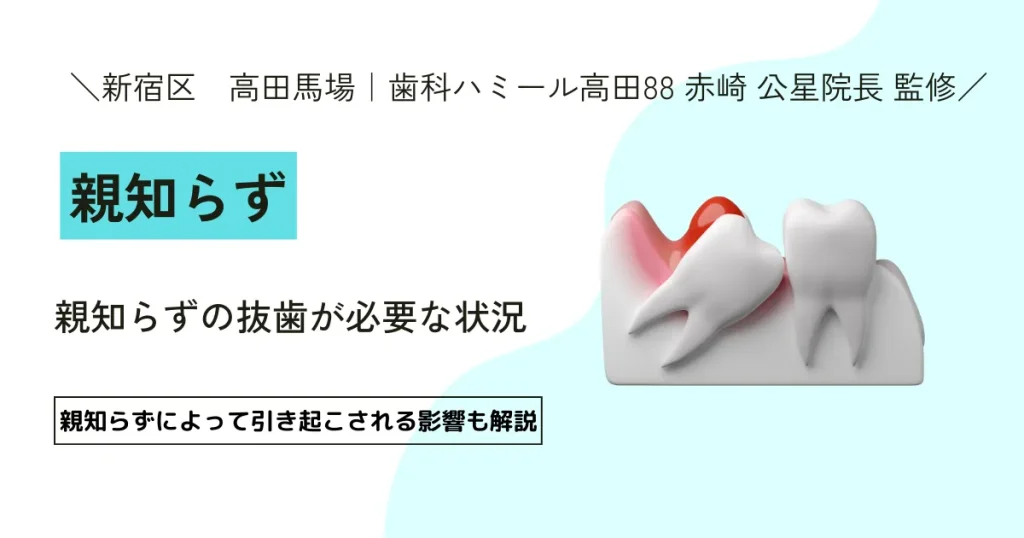 【9割が知らない】親知らずの生え方のパターン