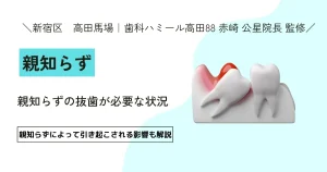 【9割が知らない】親知らずの生え方のパターン