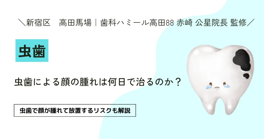 虫歯による顔の腫れは何日で治るのか？ 【医師監修】