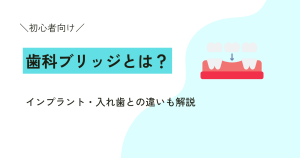 【初心者向け】歯科ブリッジとは？インプラント・入れ歯との違いも解説