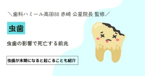 虫歯の影響で死亡する前兆【医師監修】