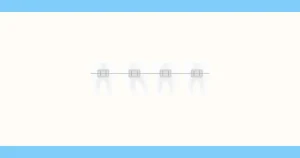 【高田马场】选择适合的牙齿矫正医生的7个技巧｜详细解读治疗流程