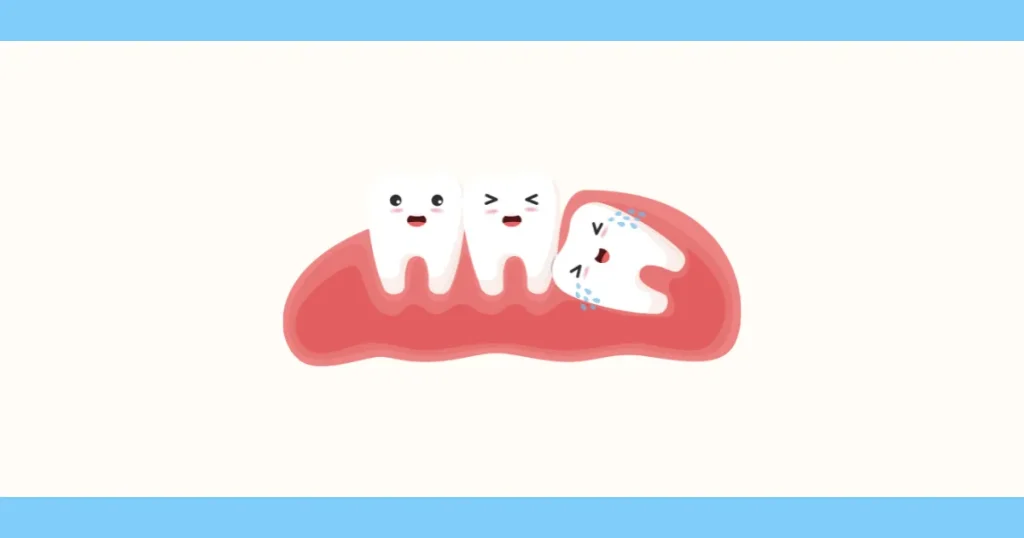 【高田马场｜歯科ハミール高田88】全身麻醉下拔除智齿的三大好处｜全面解析安全性与风险