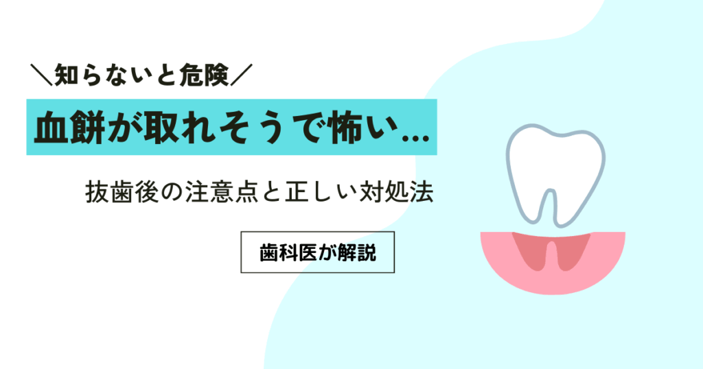 血餅が取れそうで怖い…抜歯後の注意点と正しい対処法を歯科医が解説