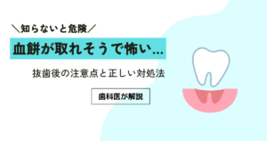 血餅が取れそうで怖い…抜歯後の注意点と正しい対処法を歯科医が解説