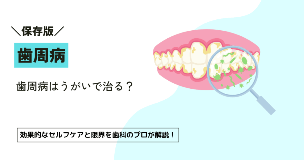 歯周病はうがいで治る？効果的なセルフケアと限界を歯科のプロが解説！