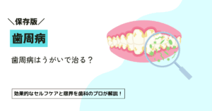 歯周病はうがいで治る？効果的なセルフケアと限界を歯科のプロが解説！