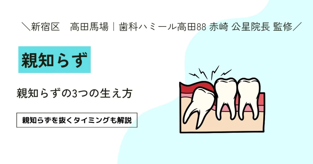 【保存版】親知らずの3つの生え方｜親知らずを抜くタイミングも解説