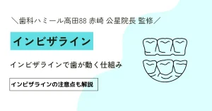 【完全ガイド】インビザラインで歯が動く仕組み