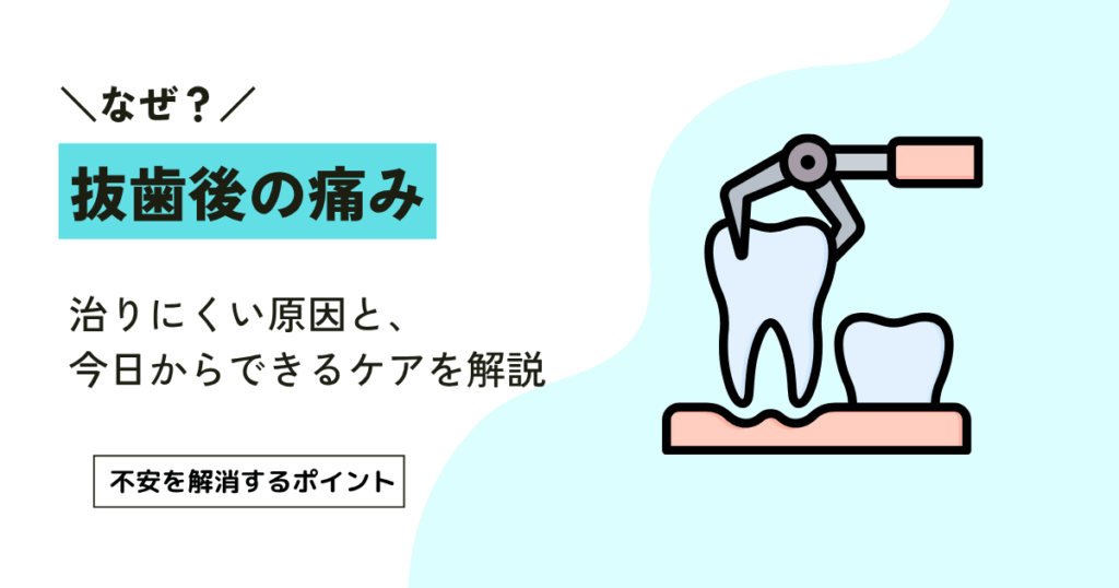 抜歯後は何日痛いの？痛みが続く3つの目安と今日できるケア