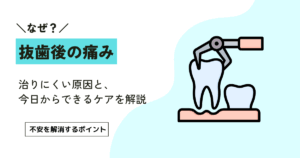 抜歯後は何日痛いの？痛みが続く3つの目安と今日できるケア