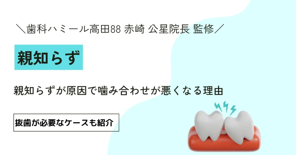 親知らずが原因で噛み合わせが悪くなる理由｜抜歯が必要なケースも紹介