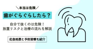 ぐらぐらの歯を自分で抜くと危険？大人が避けるべきリスクと正しい対処法