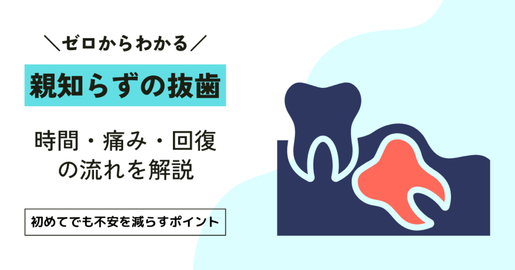 親知らずの抜歯にかかる時間｜上下・本数別の目安と回復期間
