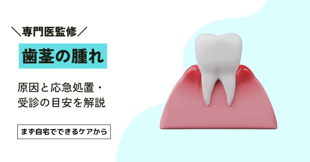 歯茎が腫れた時の対処法4選｜自宅でできる応急処置と歯医者に行く目安