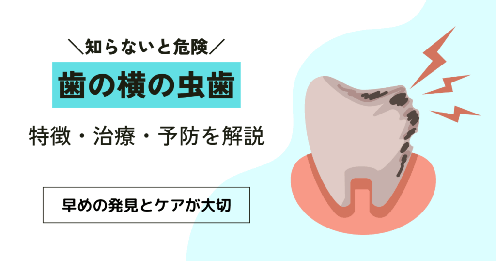 歯の横にできる虫歯の3つの特徴と、放置すると起こる2つのリスク