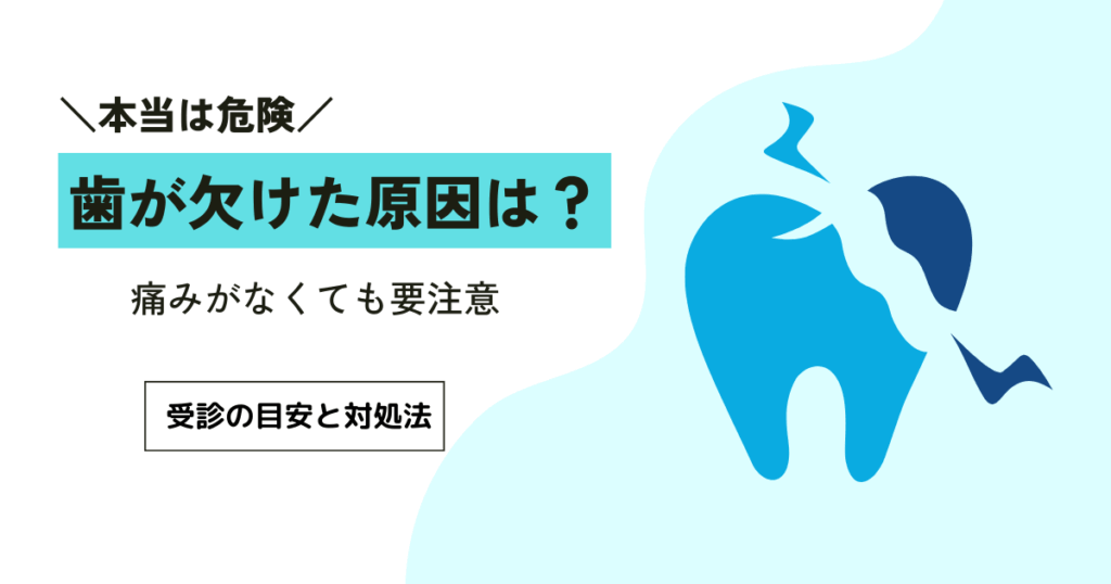 虫歯で歯が欠ける進行の理由と痛みがなくても危ない2つのサイン