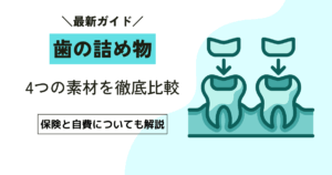 【歯の治療】詰め物は保険と自費でどう違う？選ぶ前に知っておくべき3つの違い