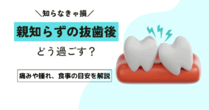 親知らずの抜歯後はどう過ごす？痛みや腫れ、食事の目安を解説