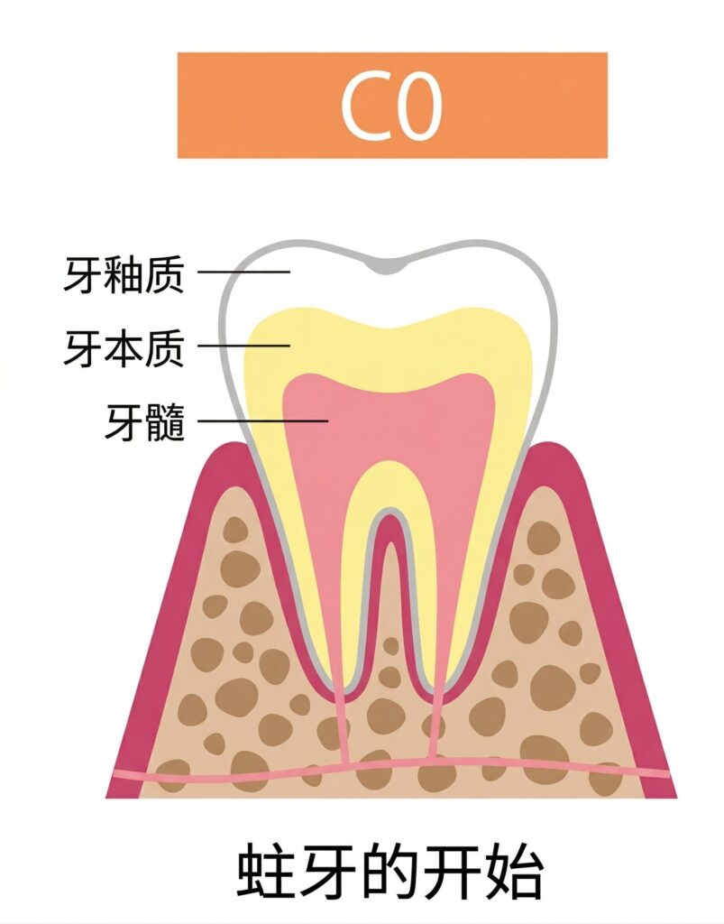 龋齿治疗｜东京高田马场牙科诊所