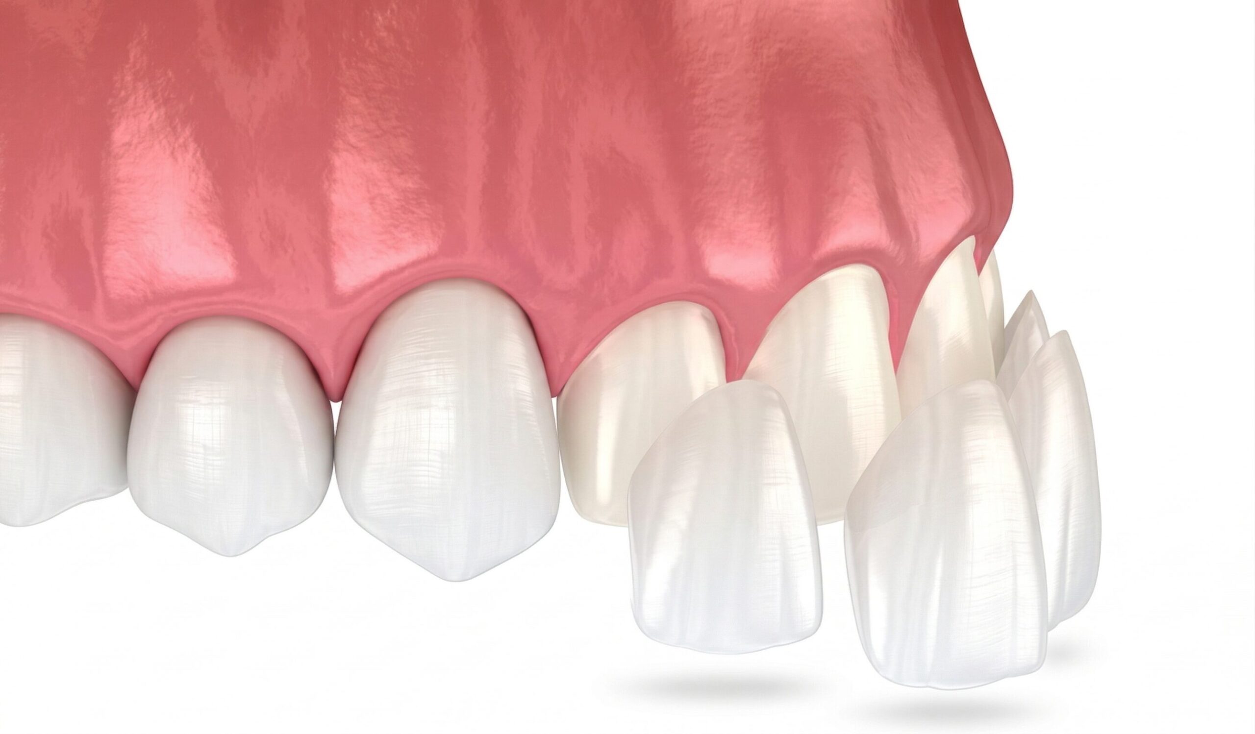 エンジェルベニア