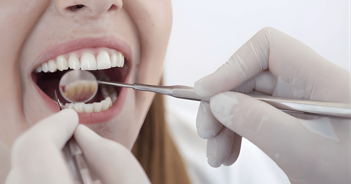 親知らず　トラブル