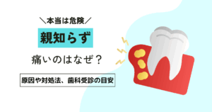 親知らずが痛いのはなぜ？原因や対処法、歯科受診の目安