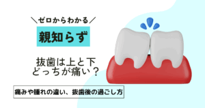親知らずの抜歯は上と下どっちが痛い？痛みや腫れの違い、抜歯後の過ごし方