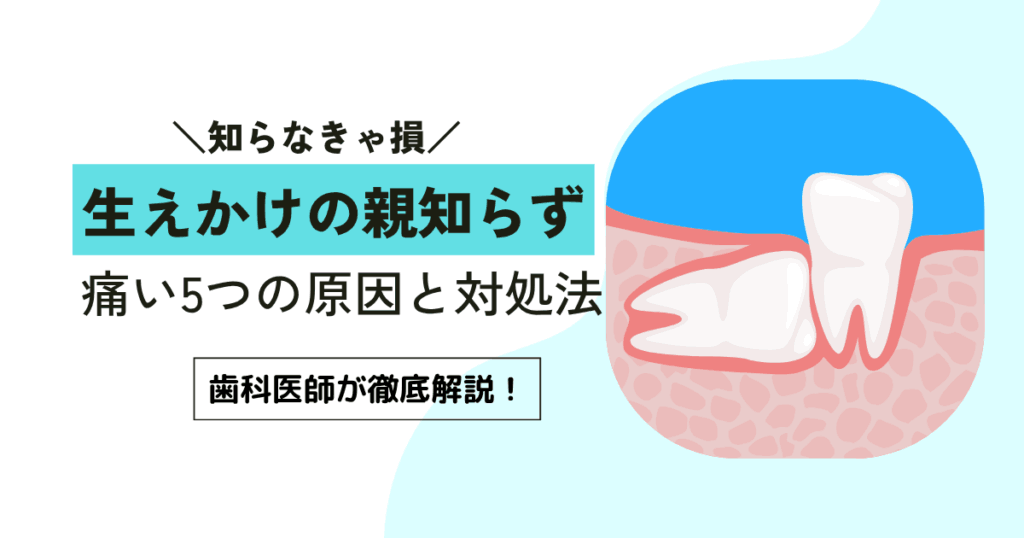 生えかけの親知らずが痛い5つの原因と対処法