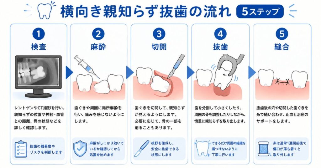 親知らず抜歯の流れ