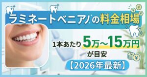 ラミネートベニアの料金相場は1本あたり5万〜15万円が目安【2025年最新】