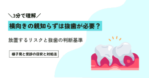 親知らずが横向きに生えると抜歯が必要？放置するリスクと抜歯の判断基準を解説