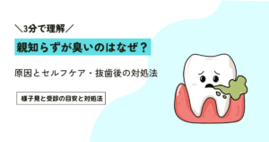 親知らずが臭いのはなぜ？原因とセルフケア・抜歯後の対処法まで解説