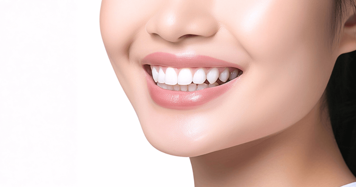 インプラントとセラミックを見た目重視で選ぶ際の考え方を示すイメージ