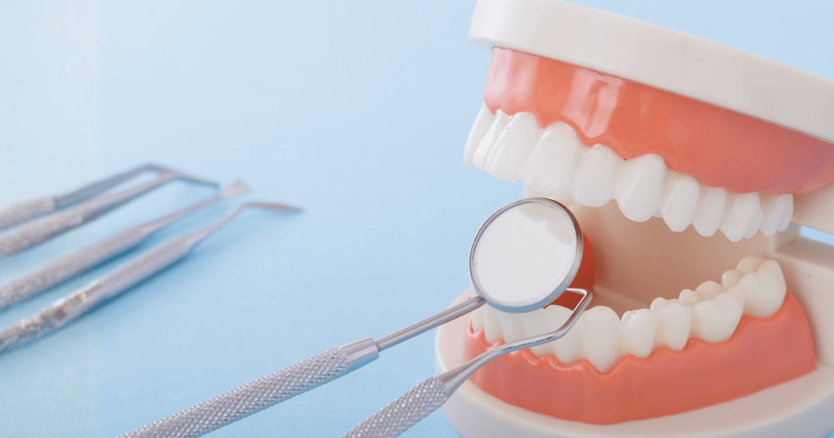 歯科の模型とミラーを使って歯の欠けや状態を確認している様子の写真